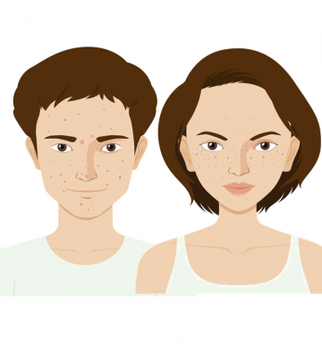 Acne and psychological trauma